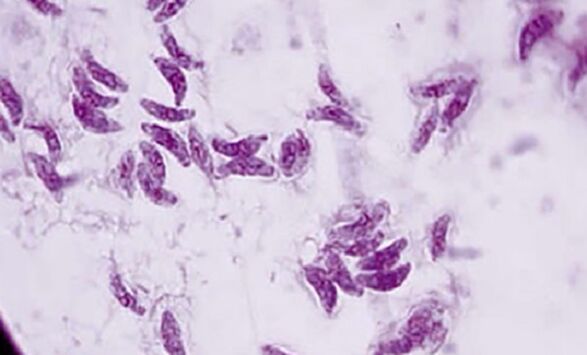 parasitäres Protozoen-Toxoplasma gondii, der Erreger der Toxoplasmose