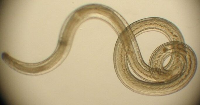parasitärer Wurm aus dem menschlichen Körper