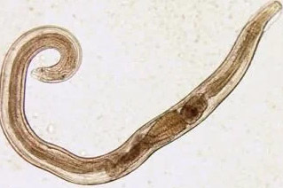 die parasiten, die menschen pinworms
